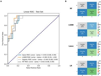 Targeted plasma metabolomics combined with machine learning for the diagnosis of severe acute respiratory syndrome virus type 2